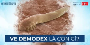 ve demodex