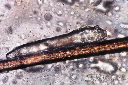 Ký sinh trùng Demodex dưới ống kính hiển vi