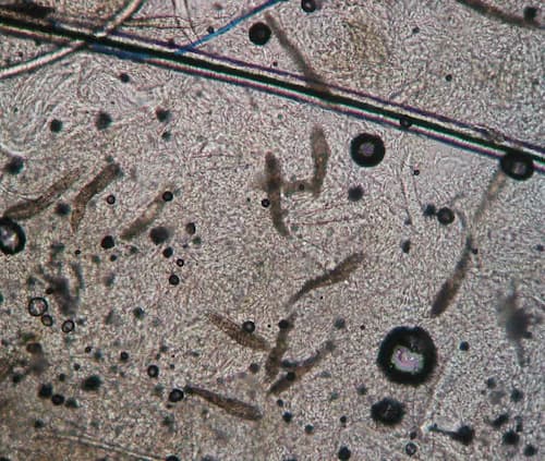 Vi khuẩn demodex trên kính hiển vi