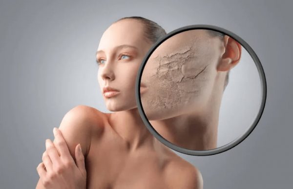 Thiếu hụt collagen và elastin khiến da khô cằn, nứt nẻ