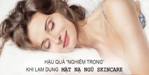 mat na ngu skin care - Anh bia