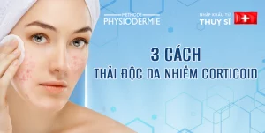 thai doc da nhiem corticoid thumbnail