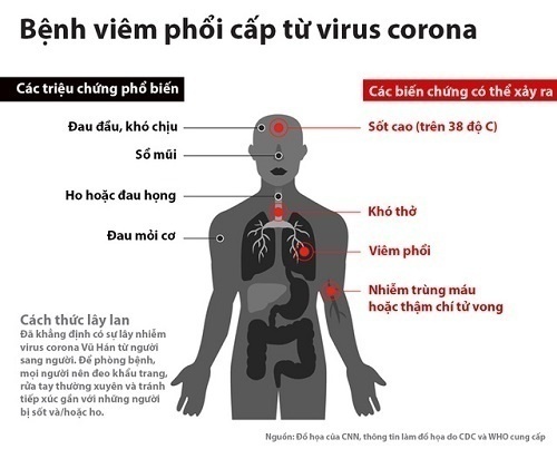Các triệu chứng của bệnh viêm phổi cấp từ virus corona