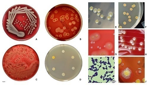 Tụ cầu khuẩn Staphylococcus aureus