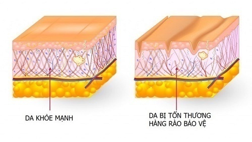 Hàng rào bảo vệ da chính là lớp màng ngoài cùng của biểu bì
