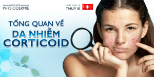 tổng quan về da nhiễm corticoid