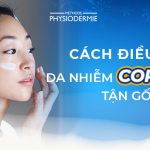 cach-dieu-tri-da-nhiem-corticoid-thumbnail