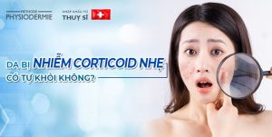 da bị nhiễm corticoid nhẹ