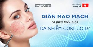 da nhiễm corticoid