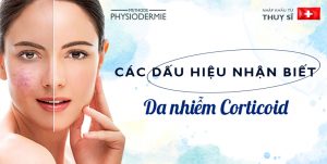 dấu hiệu da nhiễm corticoid