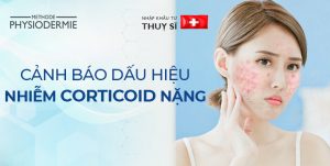 dấu hiệu bị nhiễm corticoid