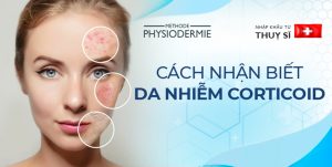 nhận biết da nhiễm corticoid