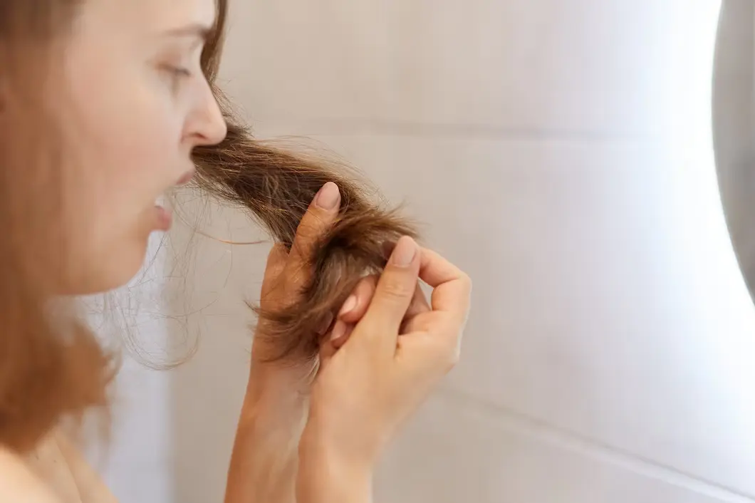 Rụng tóc sau sinh thường kéo dài từ 2-6 tháng.