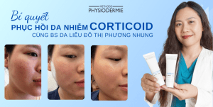 phuc-hoi-da-nhiem-corticoid-cung-bac-i-da-lieu